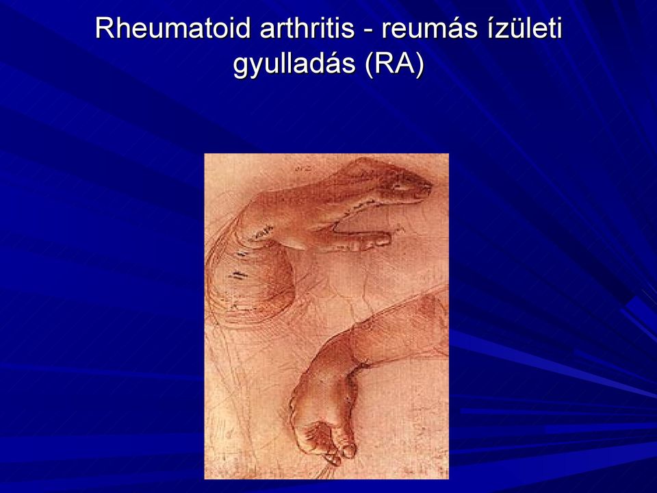 akut rheumatoid arthritisben szenvedő beteg ellátása)