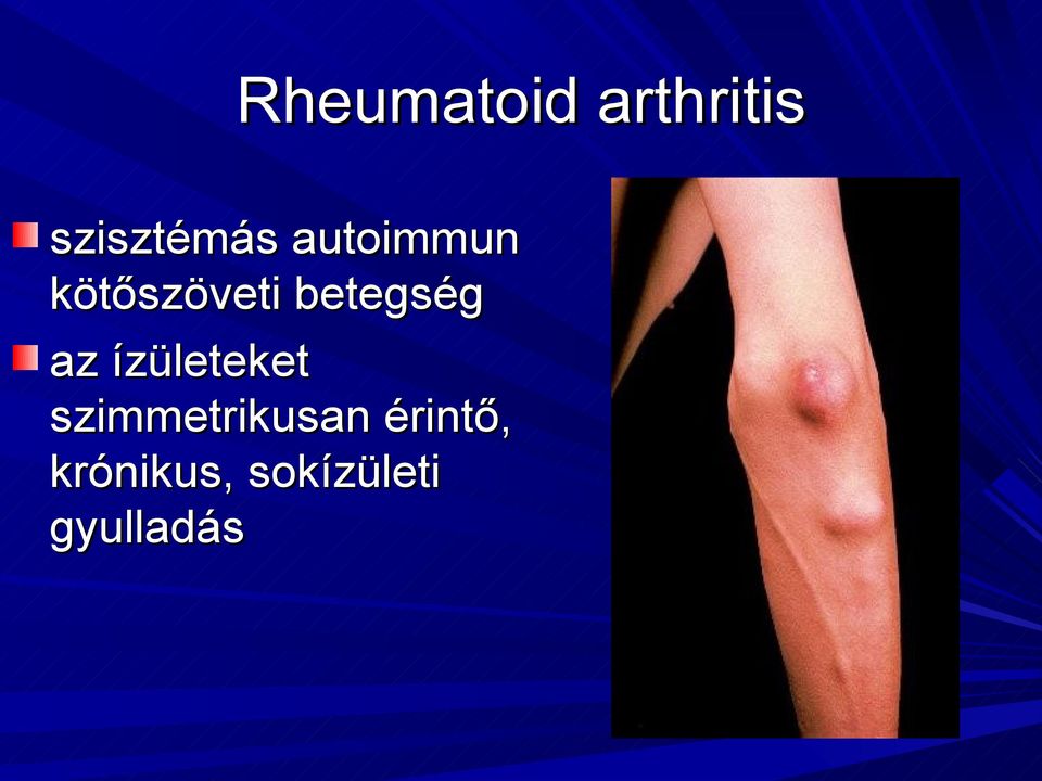akut rheumatoid arthritis esettanulmánya)