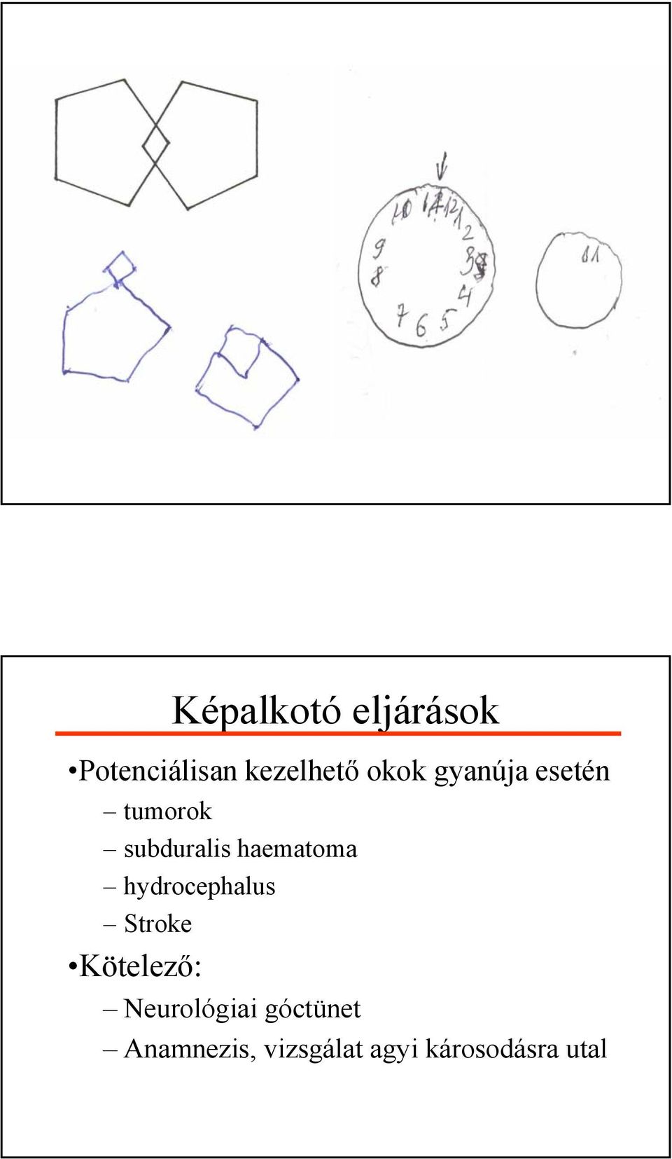 haematoma hydrocephalus Stroke Kötelező: