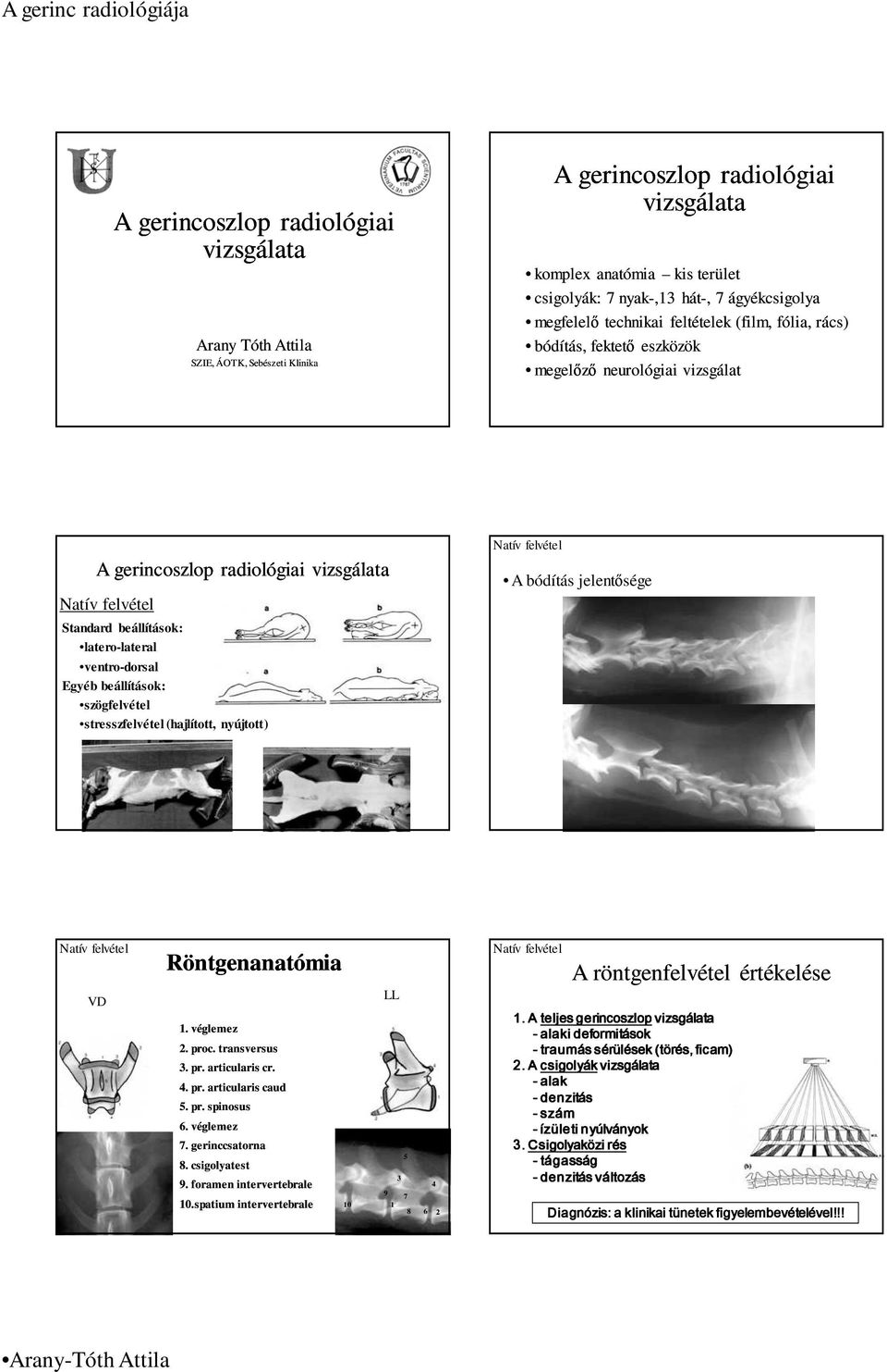 Egyéb beállítások: szögfelvétel stresszfelvétel (hajlított, nyújtott) A bódítás jelentısége VD Röntgenanatómia 1. véglemez 2. proc. transversus 3. pr. articularis cr. 4. pr. articularis caud 5. pr. spinosus 6.