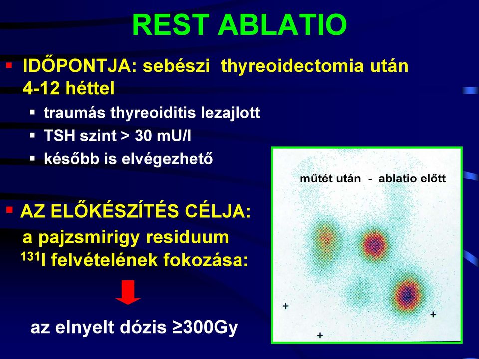 elvégezhető AZ ELŐKÉSZÍTÉS CÉLJA: a pajzsmirigy residuum 131 I