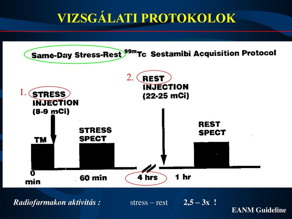 aktivitás : stress