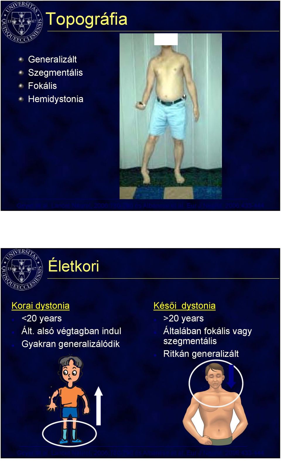 2006:433-444 Életkori Korai dystonia <20 years Ált.