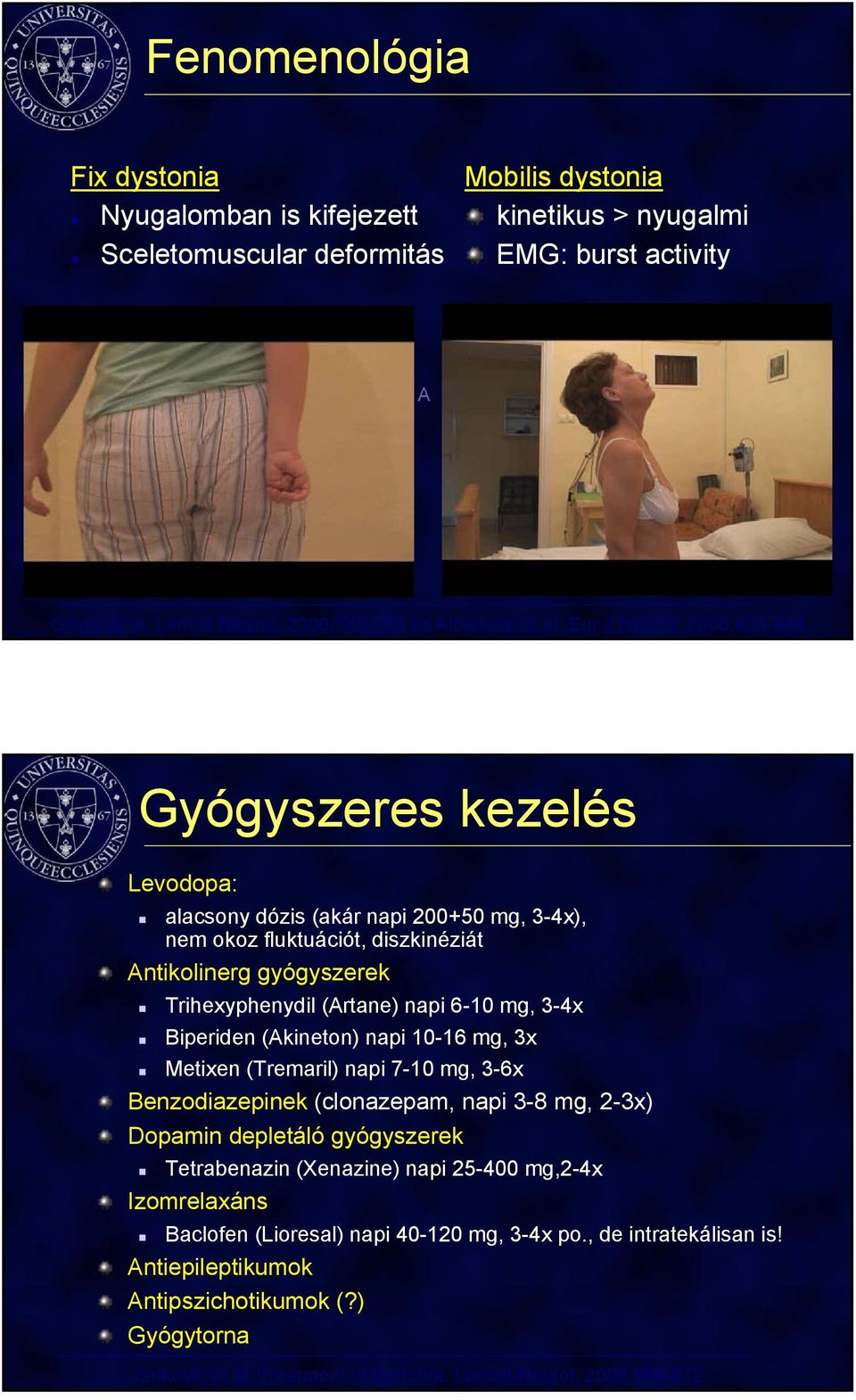 2006:433-444 Gyógyszeres kezelés Levodopa: alacsony dózis (akár napi 200+50 mg, 3-4x), nem okoz fluktuációt, diszkinéziát Antikolinerg gyógyszerek Trihexyphenydil (Artane) napi 6-10 mg, 3-4x