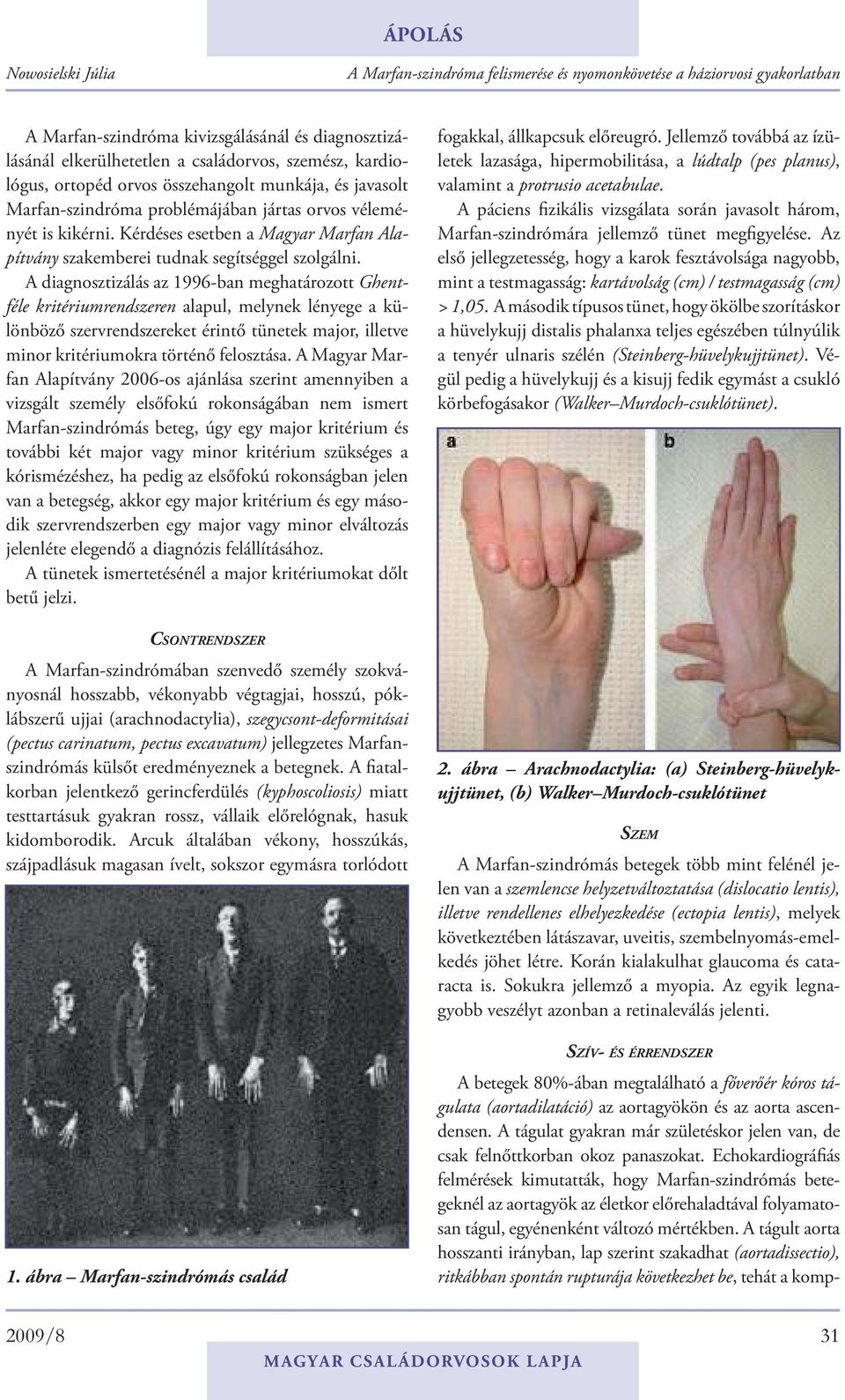 A diagnosztizálás az 1996-ban meghatározott Ghentféle kritériumrendszeren alapul, melynek lényege a különböző szervrendszereket érintő tünetek major, illetve minor kritériumokra történő felosztása.