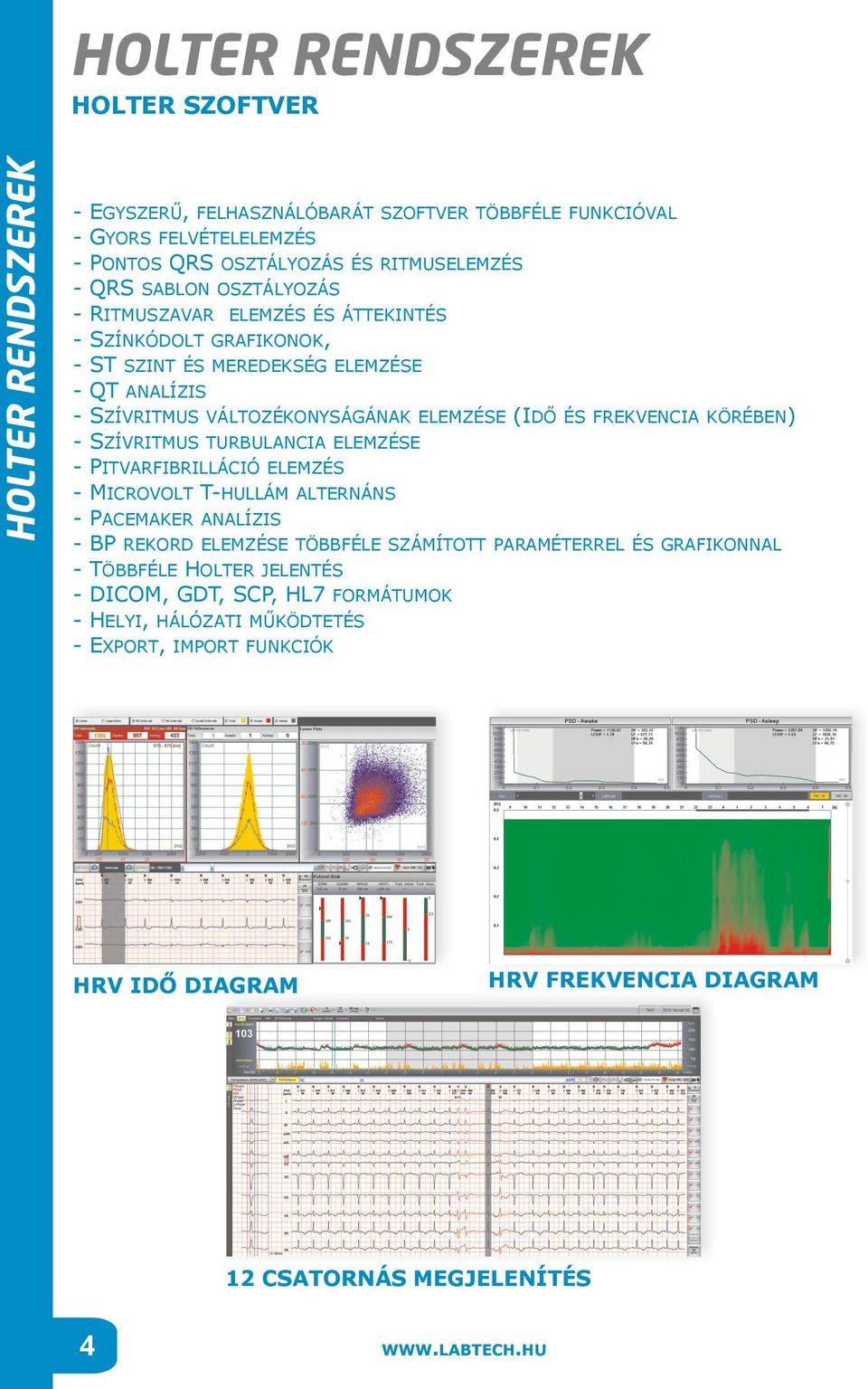 FREKVENCIA KÖRÉBEN) - SZÍVRITMUS TURBULANCIA ELEMZÉSE - PITVARFIBRILLÁCIÓ ELEMZÉS - MICROVOLT T-HULLÁM ALTERNÁNS - PACEMAKER ANALÍZIS - BP REKORD ELEMZÉSE TÖBBFÉLE SZÁMÍTOTT