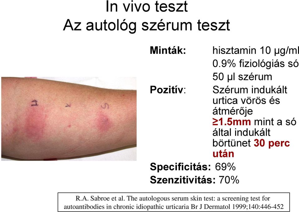 5mm mint a só által indukált börtünet 30 perc után R.A. Sabroe et al.