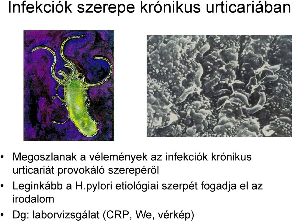 szerepéről Leginkább a H.