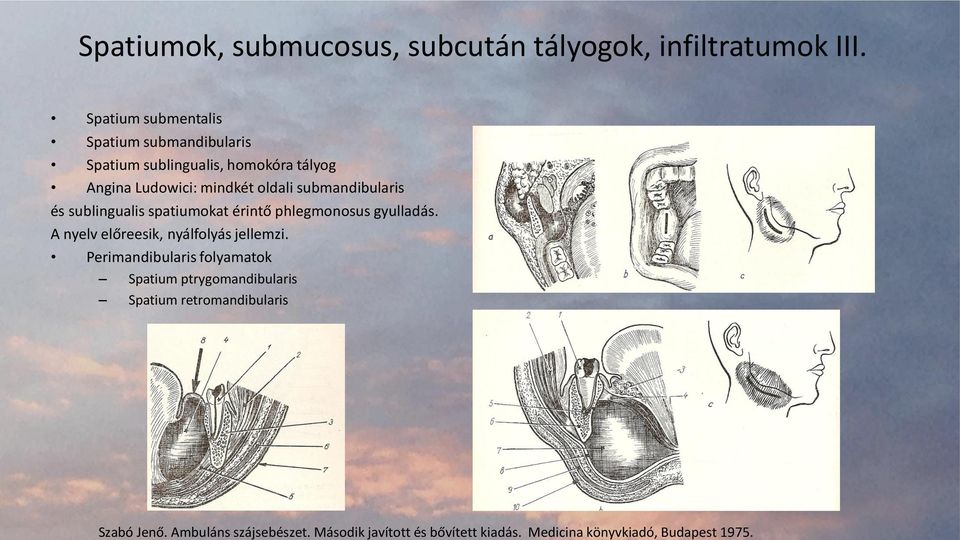 Spatium submentalis Spatium submandibularis Spatium sublingualis, homokóra tályog Angina Ludowici: mindkét oldali