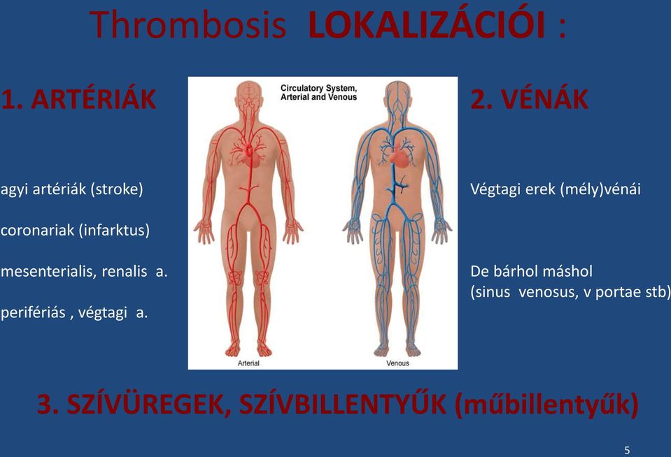 (infarktus) mesenterialis, renalis a. perifériás, végtagi a.