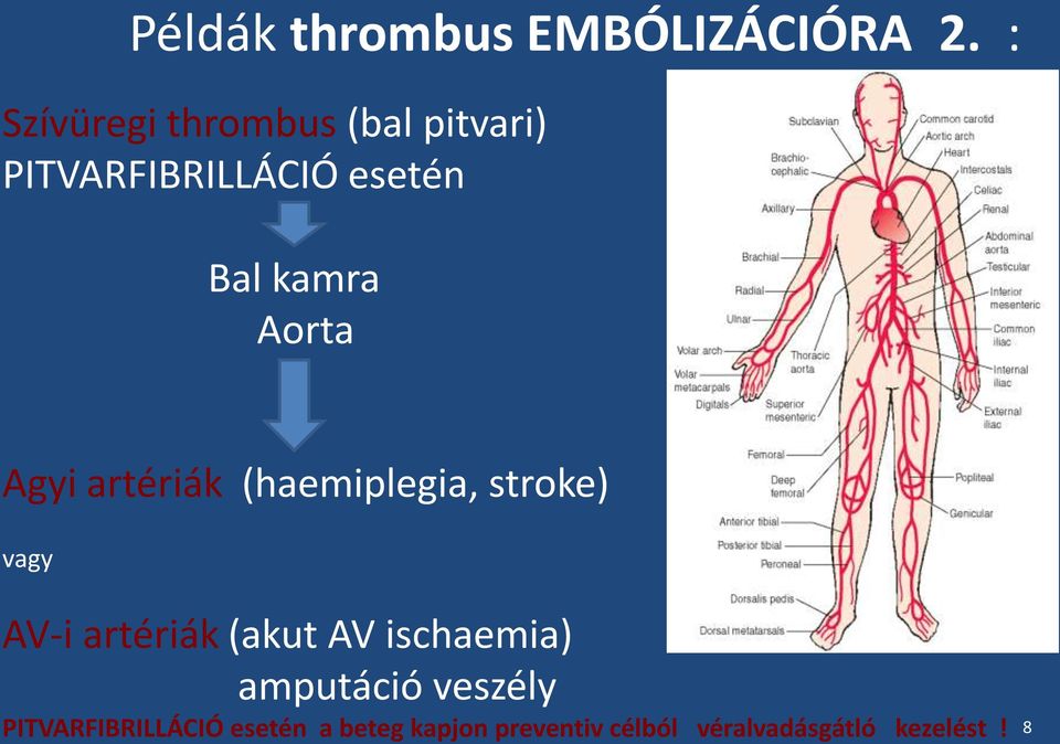 Aorta Agyi artériák (haemiplegia, stroke) vagy AV-i artériák (akut AV