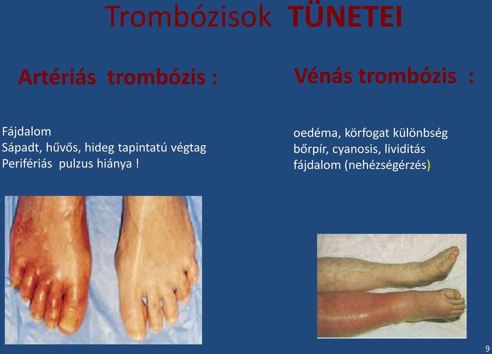 végtag Perifériás pulzus hiánya!