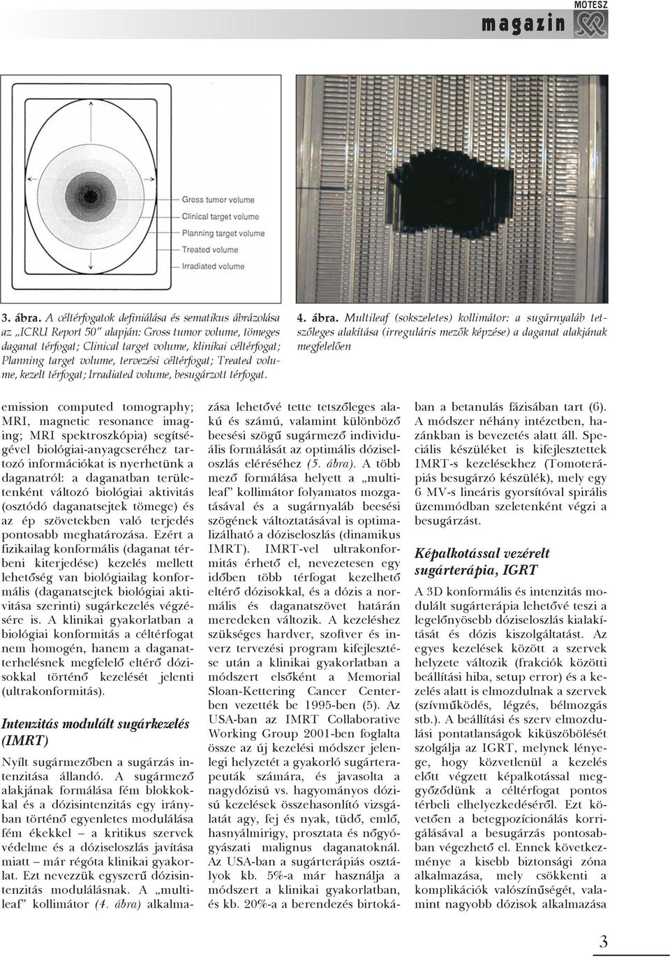 tervezési céltérfogat; Treated volume, kezelt térfogat; Irradiated volume, besugárzott térfogat. 4. ábra.