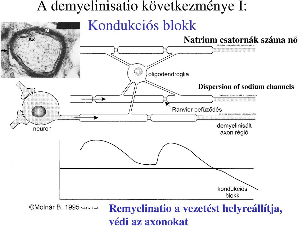 nő Dispersion of sodium channels