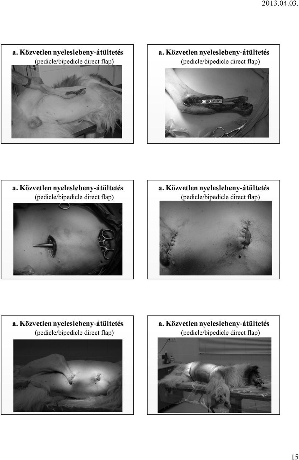 (pedicle/bipedicle direct flap)  Közvetlen nyeleslebeny-átültetés (pedicle/bipedicle direct flap) 15