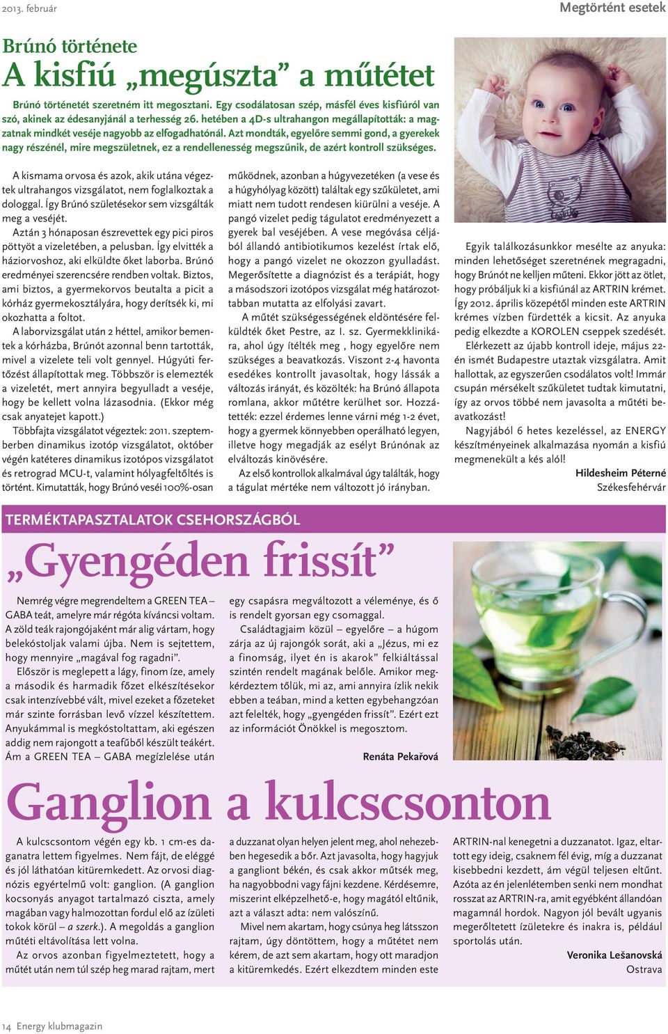 Azt mondták, egyelőre semmi gond, a gyerekek nagy részénél, mire megszületnek, ez a rendellenesség megszűnik, de azért kontroll szükséges.