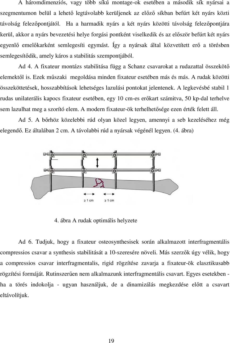 egymást. Így a nyársak által közvetített erı a törésben semlegesítıdik, amely káros a stabilitás szempontjából. Ad 4.