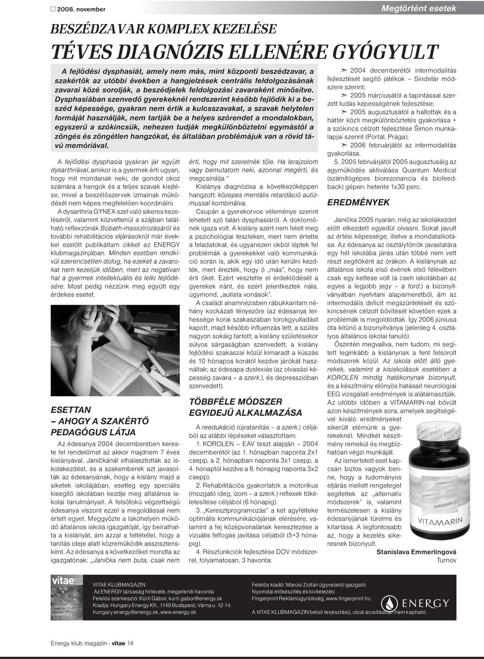 Dysphasiában szenvedő gyerekeknél rendszerint később fejlődik ki a beszéd képessége, gyakran nem értik a kulcsszavakat, a szavak helytelen formáját használják, nem tartják be a helyes szórendet a