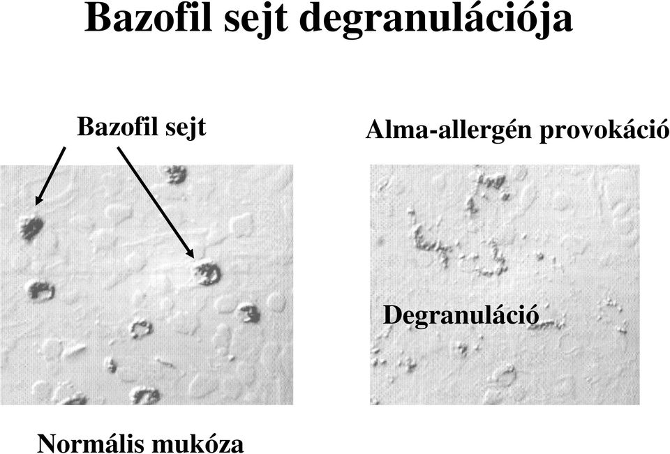 Alma-allergén