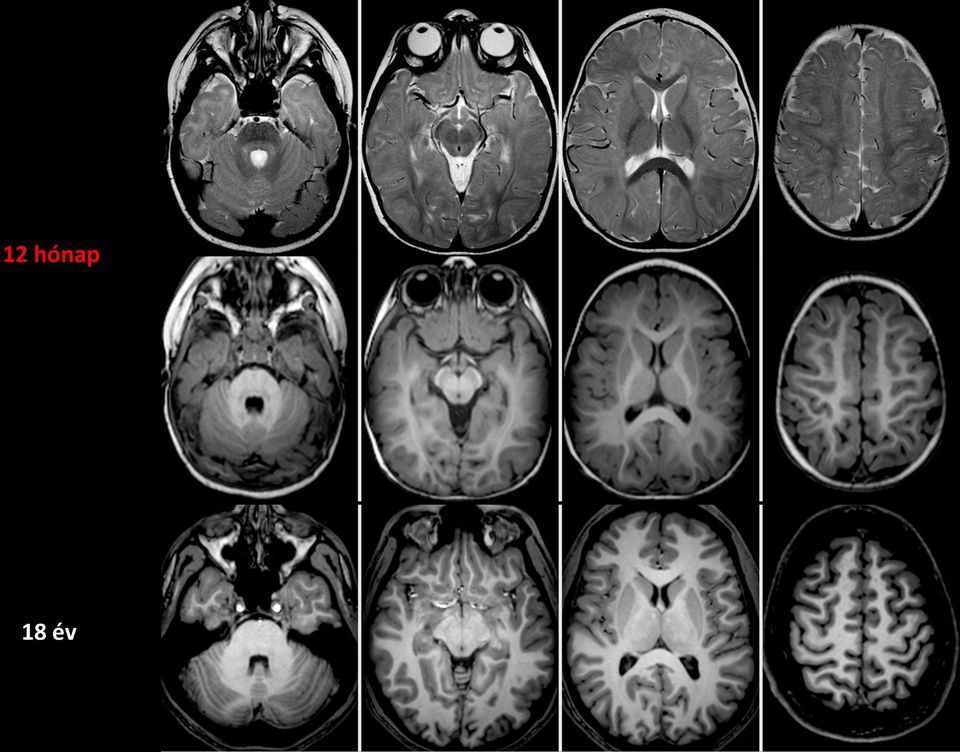 resonance imaging of