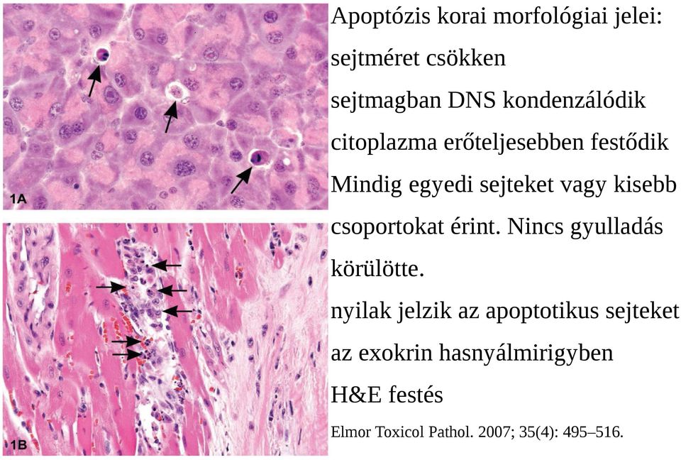 kisebb csoportokat érint. Nincs gyulladás körülötte.