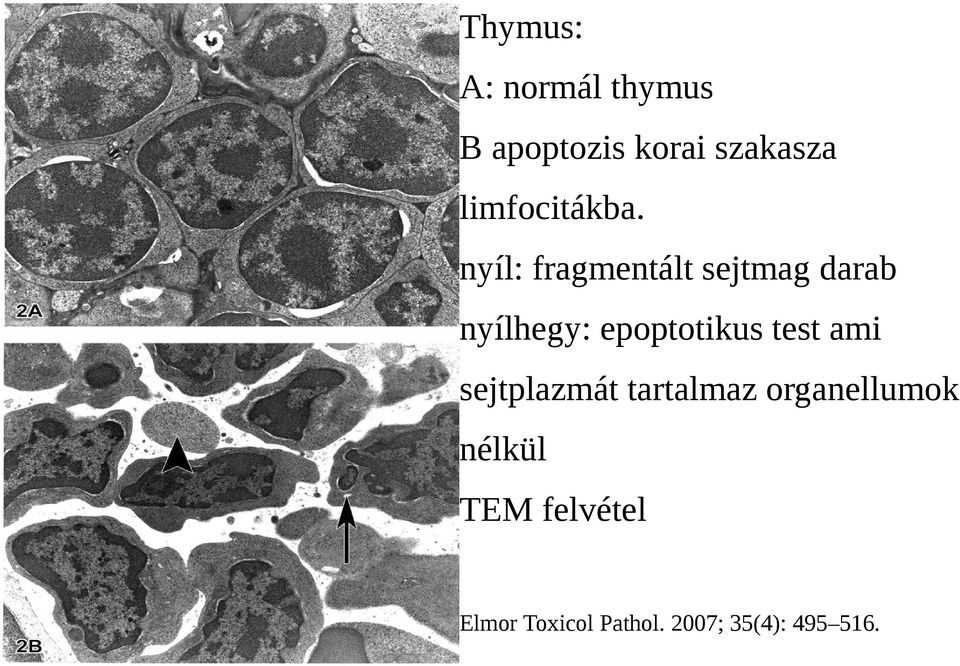 nyíl: fragmentált sejtmag darab nyílhegy: epoptotikus