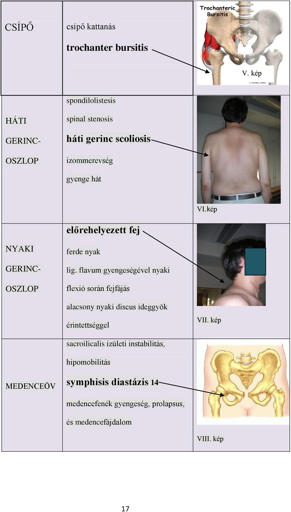 kép előrehelyezett fej NYAKI GERINC- OSZLOP ferde nyak lig.
