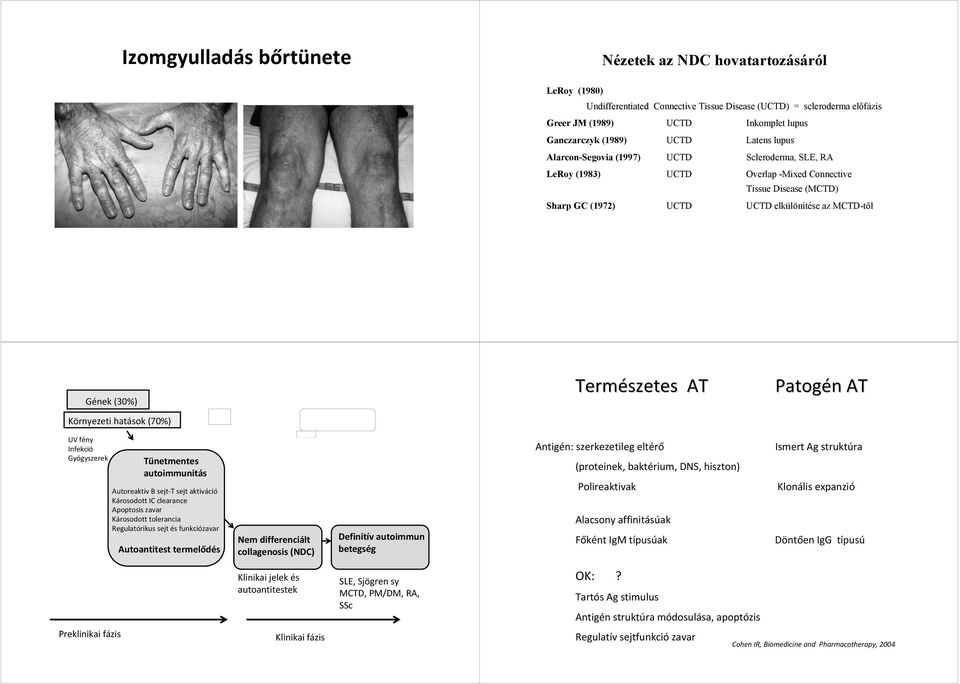 Természetes AT Patogén n AT Környezeti hatások (70%) UV fény Infekció Gyógyszerek Tünetmentes autoimmunitás Autoreaktiv B sejt-t sejt aktiváció Károsodott IC clearance Apoptosis zavar Károsodott