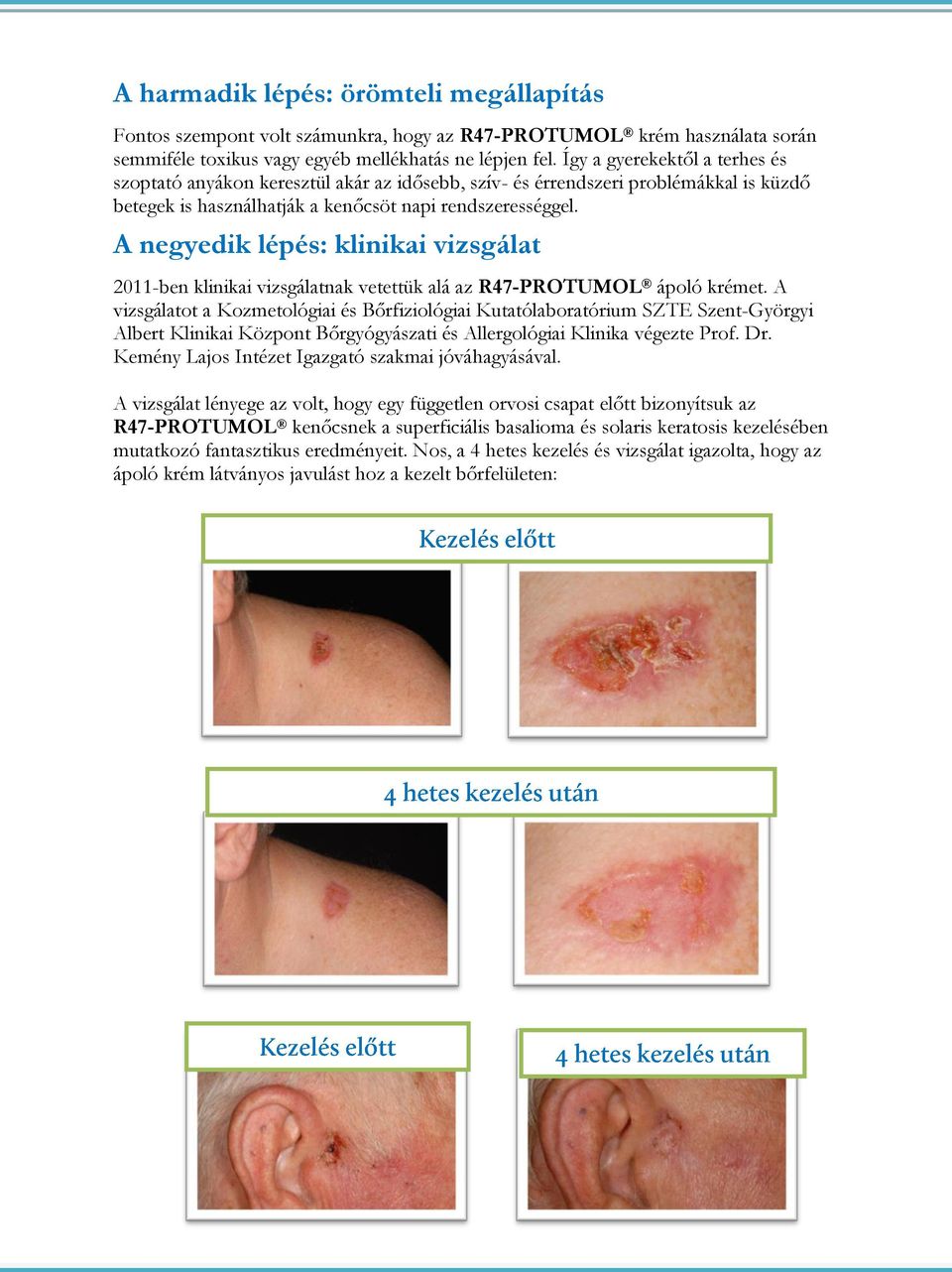 A negyedik lépés: klinikai vizsgálat 2011-ben klinikai vizsgálatnak vetettük alá az R47-PROTUMOL ápoló krémet.