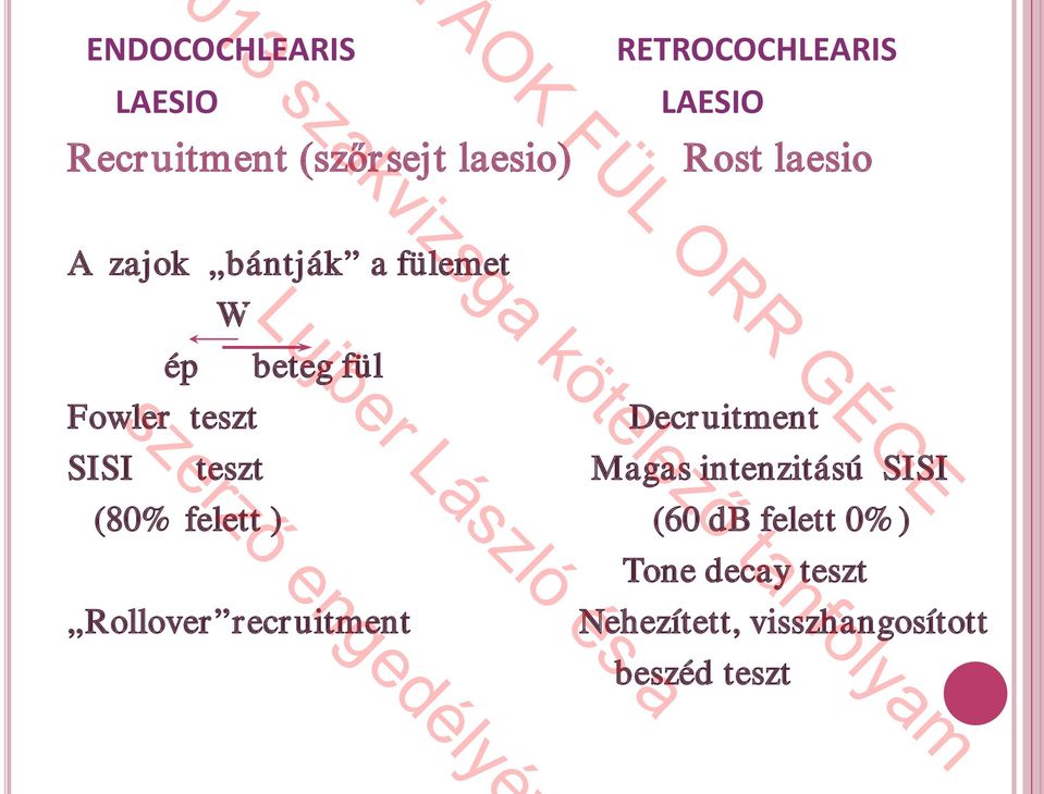 Decruitment SISI teszt Magas intenzitású SISI (80% felett ) (60 db felett