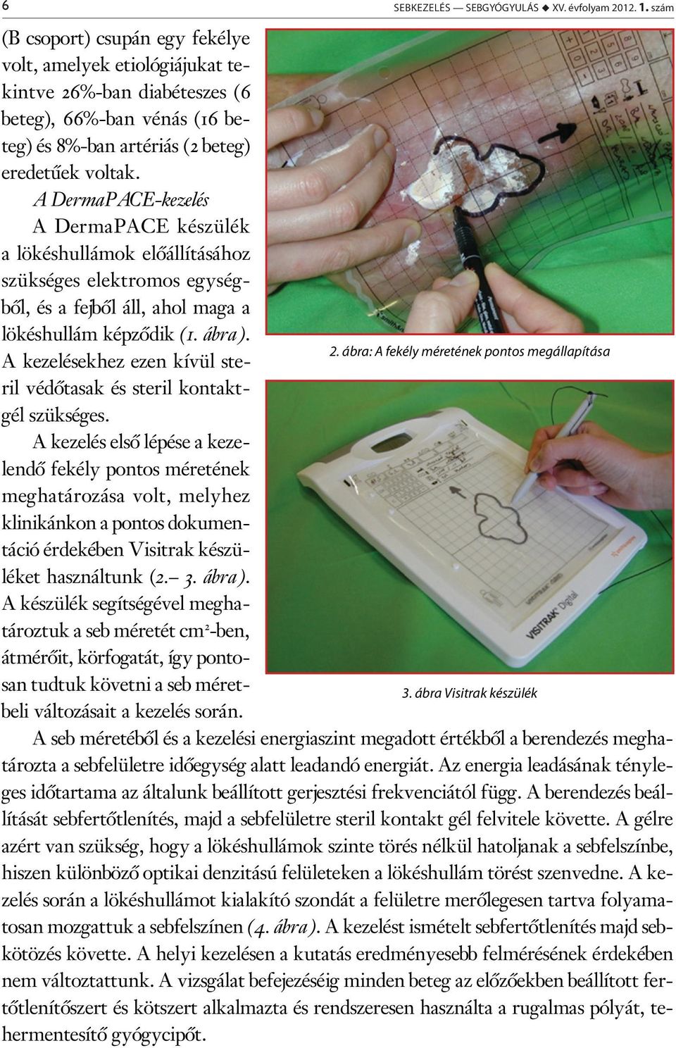 A DermaPACE-kezelés A DermaPACE készülék a lökéshullámok előállításához szükséges elektromos egységből, és a fejből áll, ahol maga a lökéshullám képződik (1. ábra). 2.