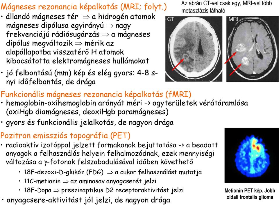 elektromágneses hullámokat jó felbontású (mm) kép és elég gyors: 4-8 s- nyi idıfelbontás, de drága CT Az ábrán CT-vel csak egy, MRI-vel több metasztázis látható Funkcionális mágneses rezonancia