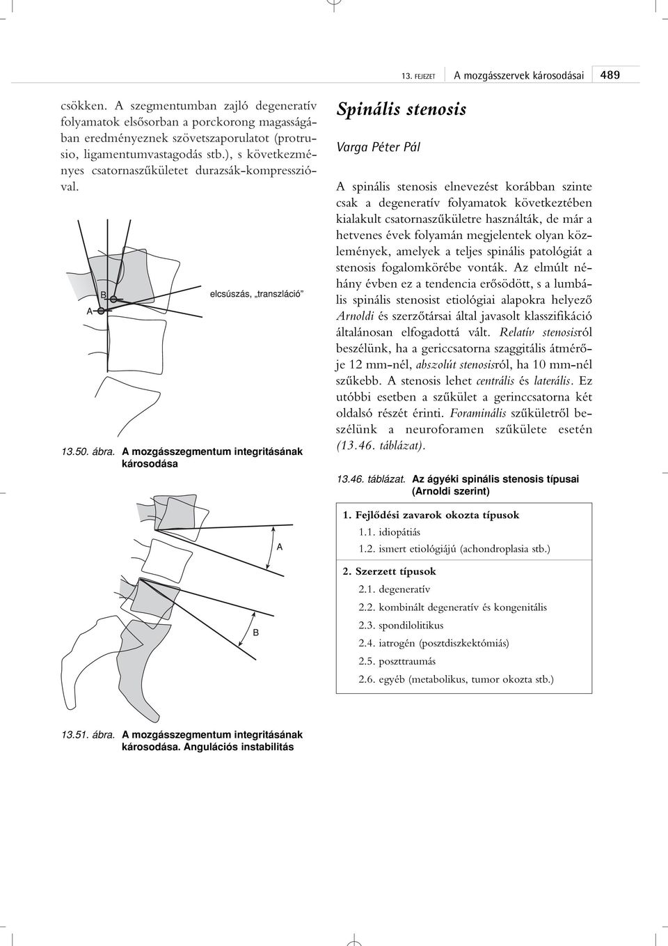 A mozgásszegmentum integritásának károsodása Spinális stenosis Varga Péter Pál A spinális stenosis elnevezést korábban szinte csak a degeneratív folyamatok következtében kialakult csatornaszûkületre