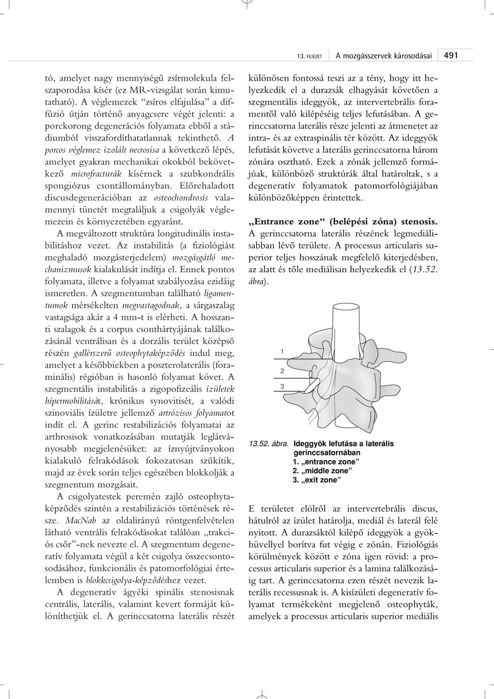 A porcos véglemez izolált necrosisa a következô lépés, amelyet gyakran mechanikai okokból bekövetkezô microfracturák kísérnek a szubkondrális spongiózus csontállományban.