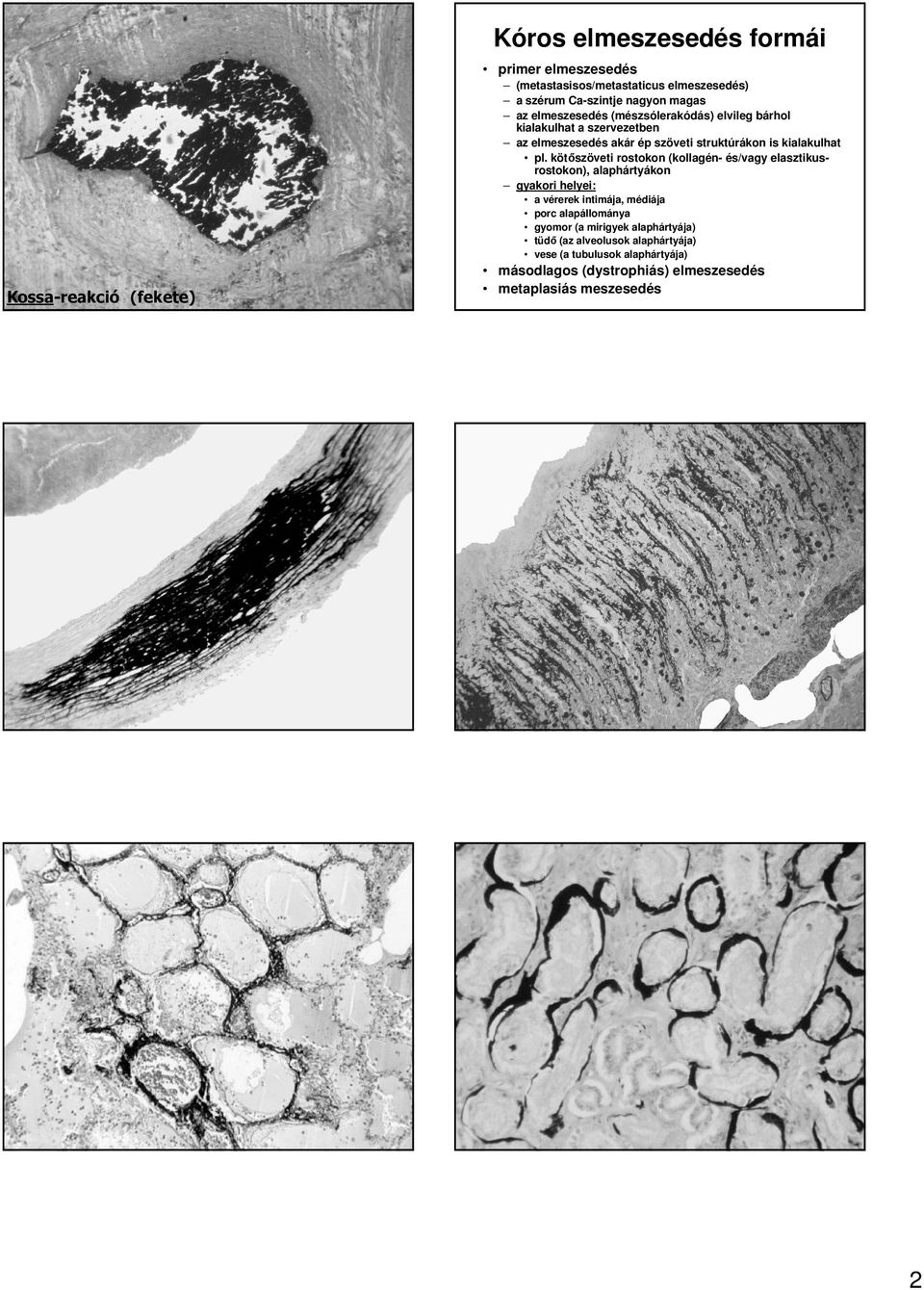 kötıszöveti rostokon (kollagén- és/vagy elasztikusrostokon), alaphártyákon gyakori helyei: Kossa-reakció (fekete) a vérerek intimája, médiája