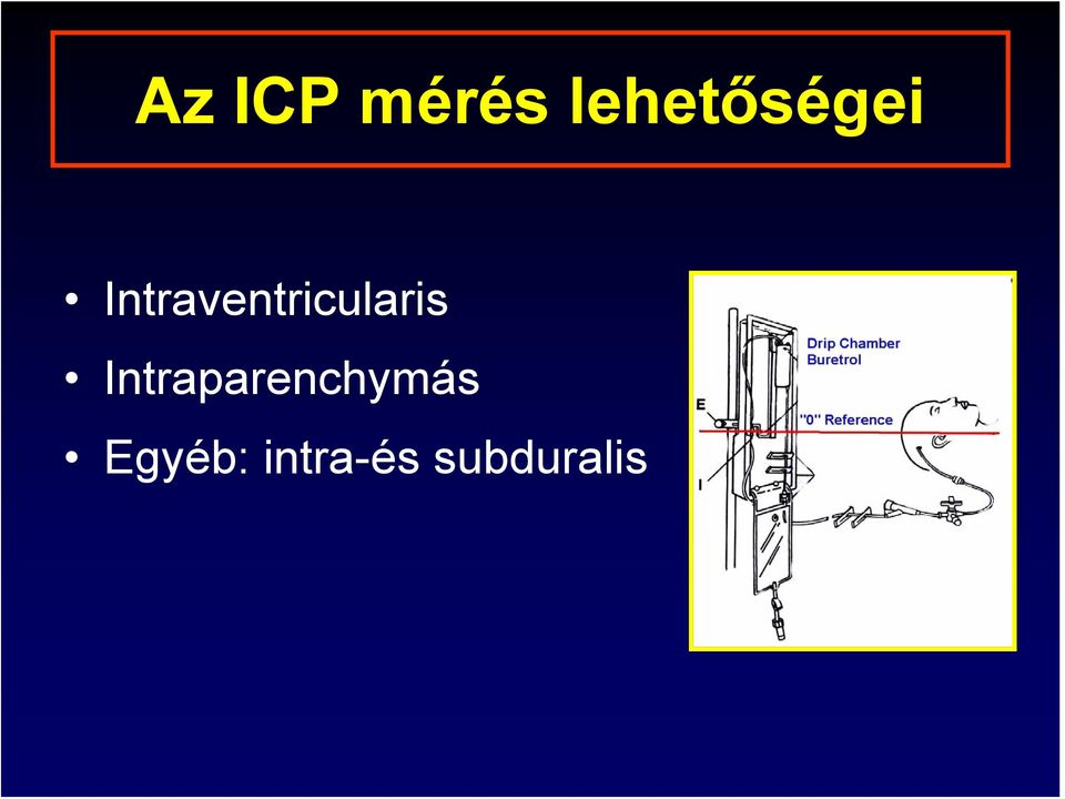 Intraventricularis