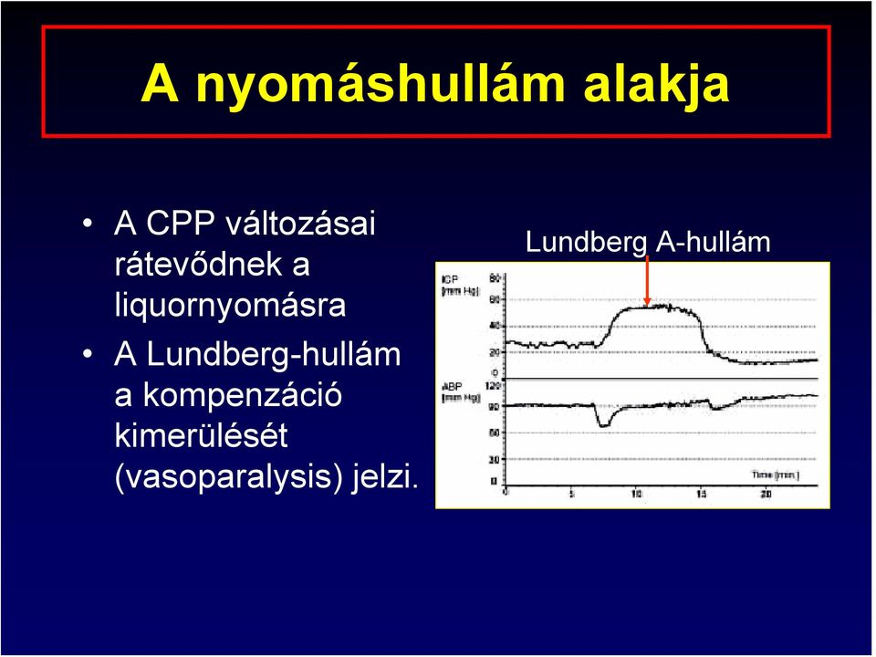 liquornyomásra A Lundberg-hullám a