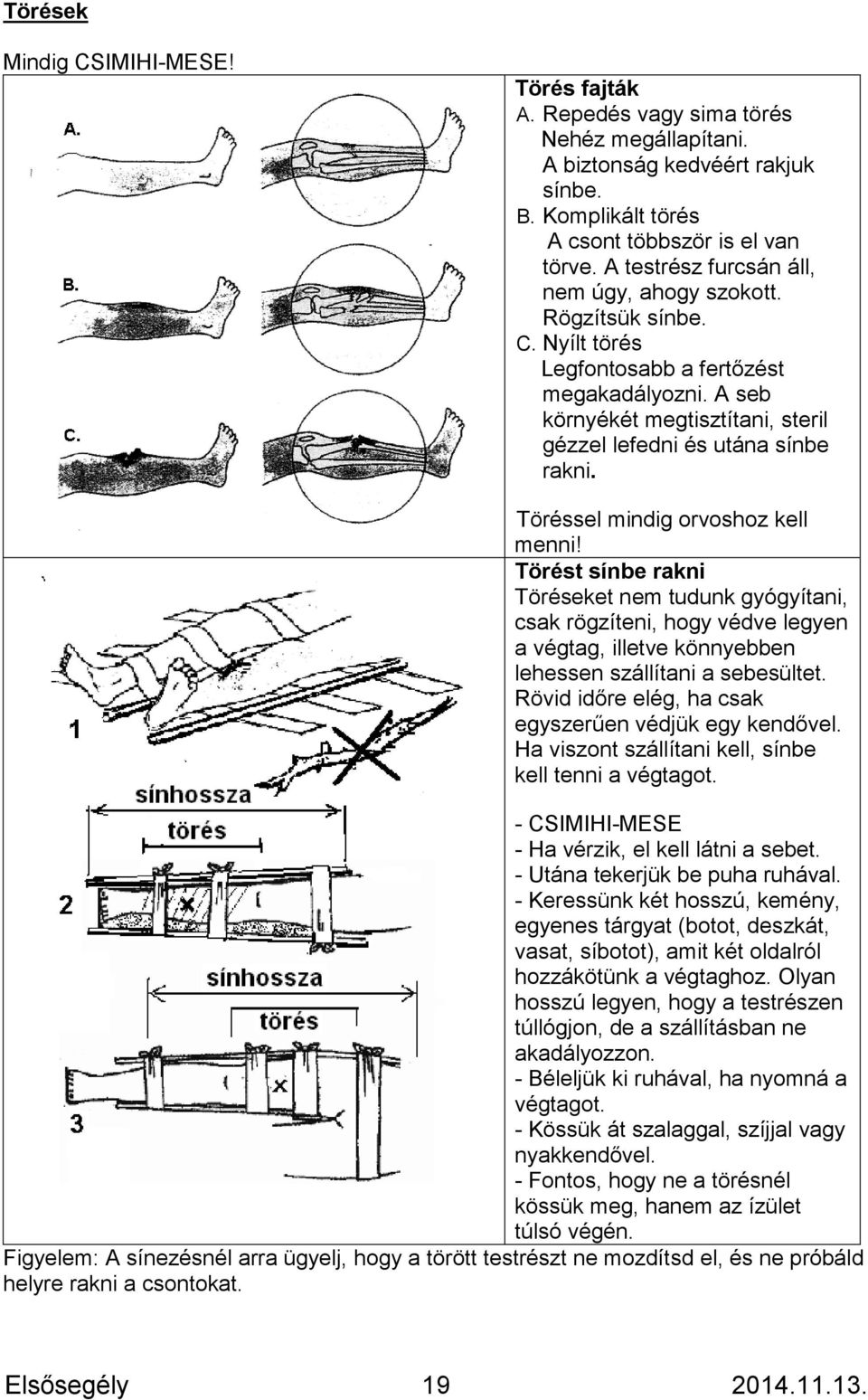 Töréssel mindig orvoshoz kell menni! Törést sínbe rakni Töréseket nem tudunk gyógyítani, csak rögzíteni, hogy védve legyen a végtag, illetve könnyebben lehessen szállítani a sebesültet.