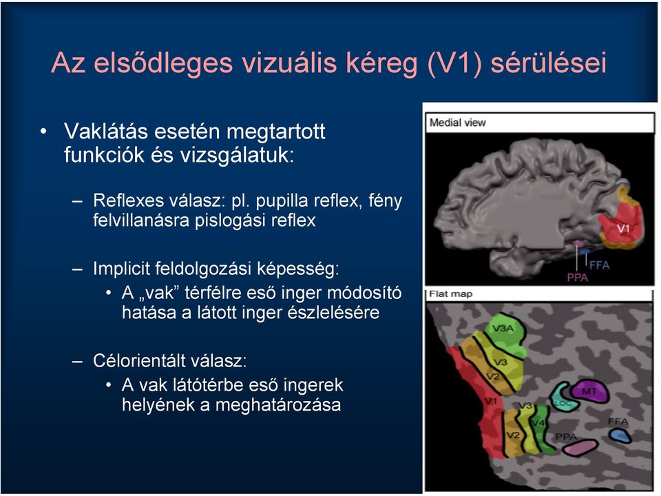 pupilla reflex, fény felvillanásra pislogási reflex Implicit feldolgozási képesség: A