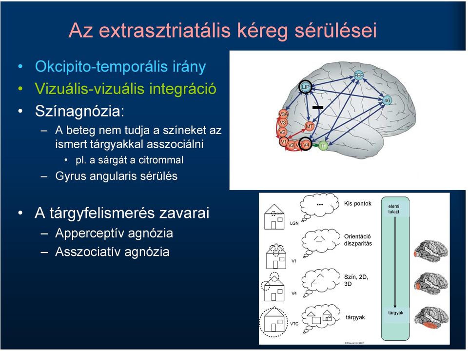 a sárgát a citrommal Gyrus angularis sérülés A tárgyfelismerés zavarai Apperceptív