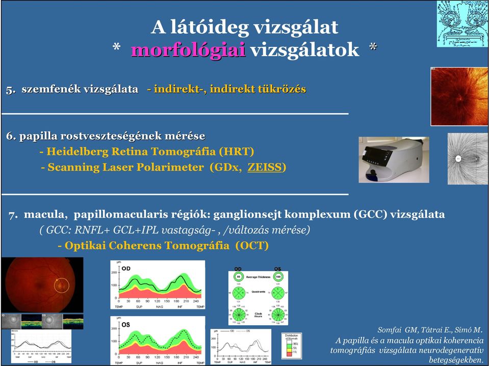 macula, papillomacularis régiók: ganglionsejt komplexum (GCC) vizsgálata ( GCC: RNFL+ GCL+IPL vastagság-, /változás mérése) -