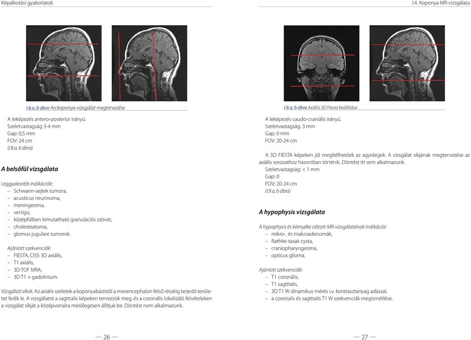 a, b ábra) A belsőfül vizsgálata Leggyakoribb indikációk: Schwann-sejtek tumora, acusticus neurinoma, meningeoma, vertigo, középfülben kimutatható granulációs szövet, cholesteatoma, glomus jugulare