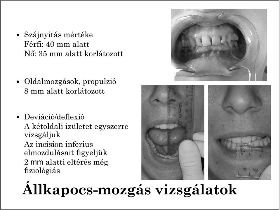 kétoldali ízületet egyszerre vizsgáljuk Az incision inferius