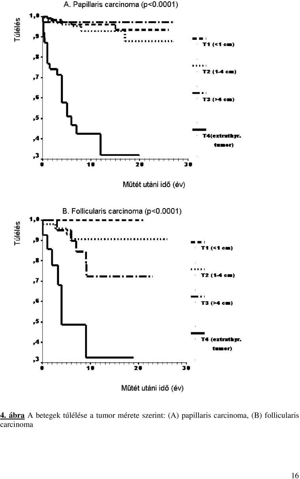 (A) papillaris carcinoma,