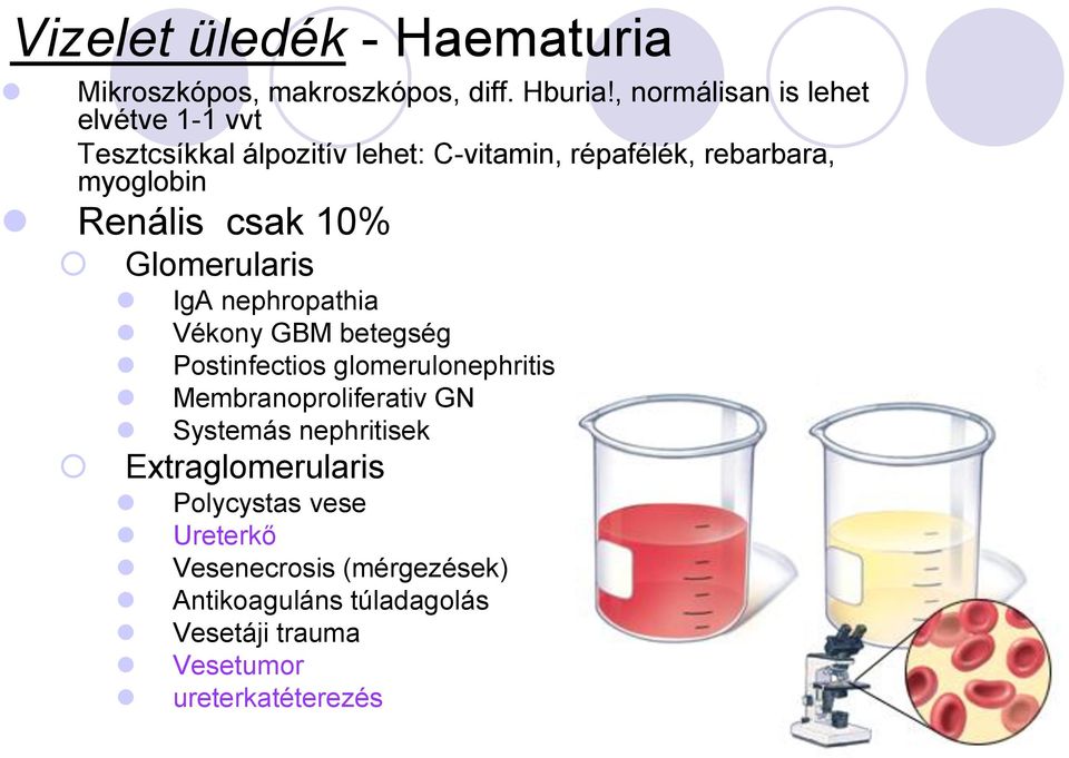 Renális csak 10% Glomerularis IgA nephropathia Vékony GBM betegség Postinfectios glomerulonephritis