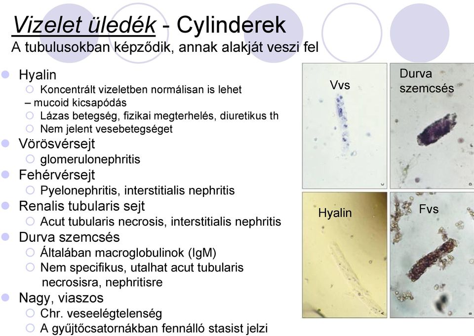 interstitialis nephritis Renalis tubularis sejt Acut tubularis necrosis, interstitialis nephritis Durva szemcsés Általában macroglobulinok (IgM) Nem