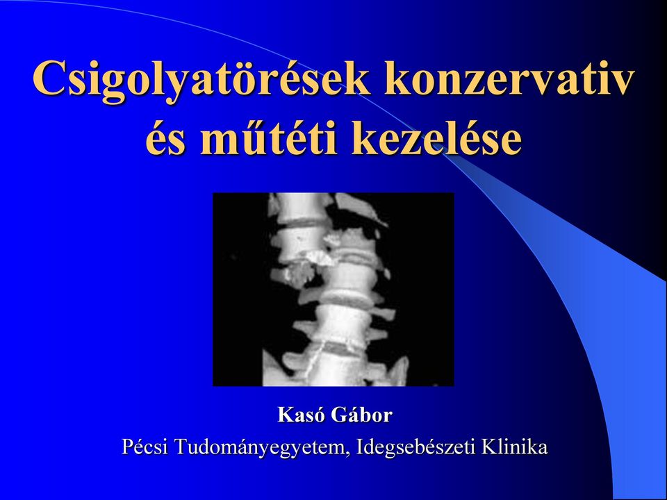 kezelése Kasó Gábor Pécsi