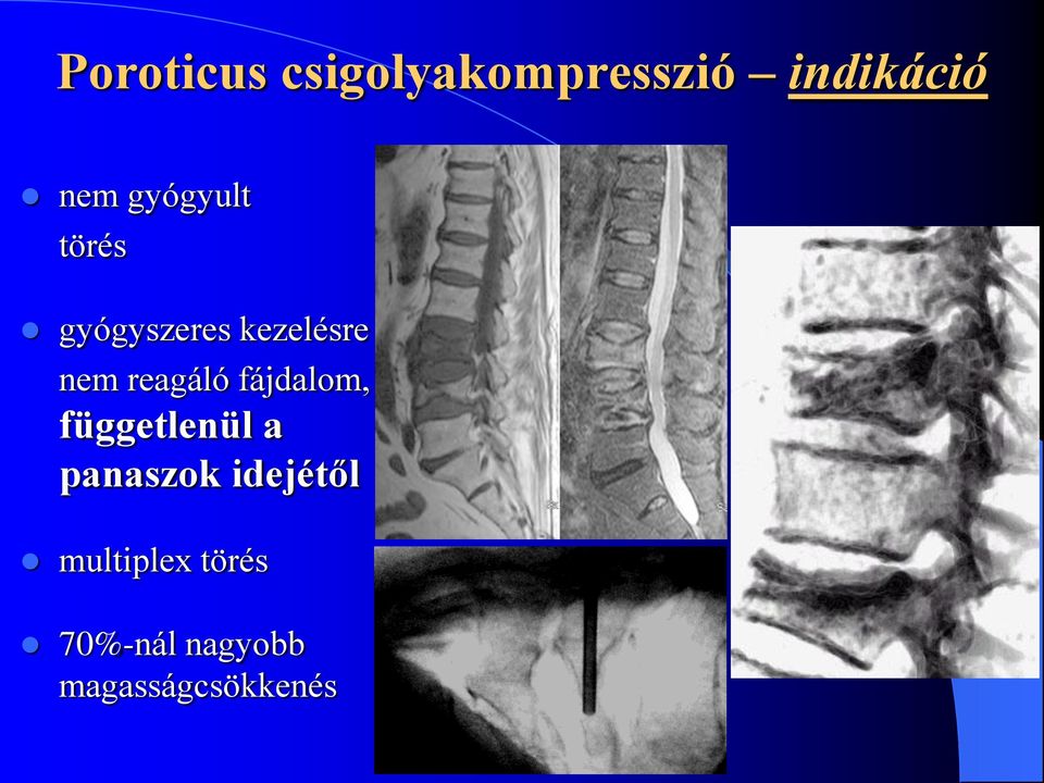 reagáló fájdalom, függetlenül a panaszok