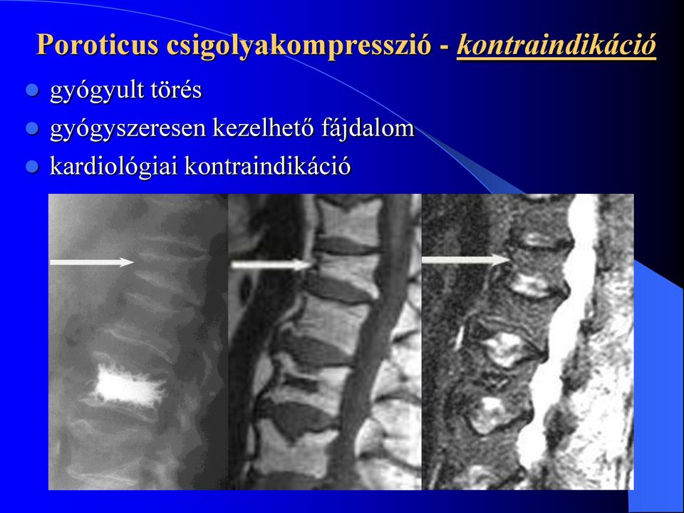 gyógyszeresen kezelhető fájdalom