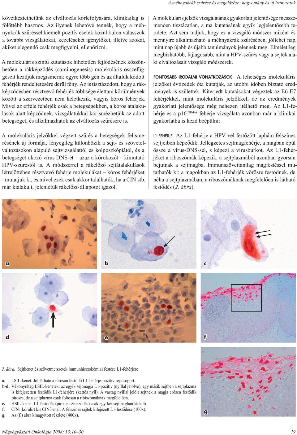 Nőgyógyászati lelet, citológiai vizsgálat jelentése és értelmezése